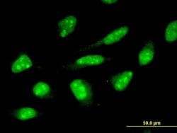 Invitrogen ZNF396 Monoclonal Antibody (2F8) 100 &mu;g; Unconjugated:Antibodies,