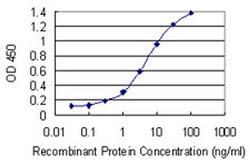 Invitrogen RNF212 Monoclonal Antibody (5H3) 100 &mu;g; Unconjugated:Antibodies,