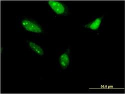 Invitrogen RNF212 Monoclonal Antibody (5H3) 100 &mu;g; Unconjugated:Antibodies,