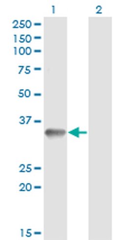 Invitrogen RNF212 Monoclonal Antibody (5H3) 100 &mu;g; Unconjugated:Antibodies,