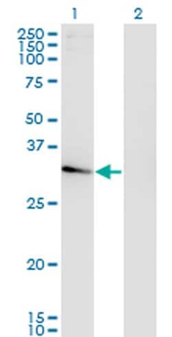 Invitrogen NACA2 Monoclonal Antibody (4H6) 100 &mu;g; Unconjugated:Antibodies,