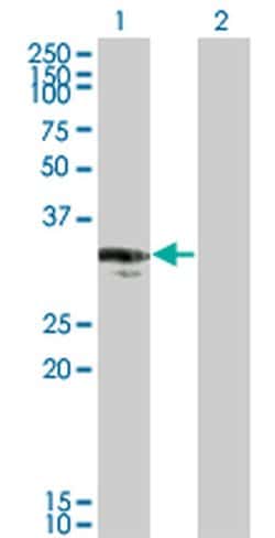 Invitrogen CENPP Monoclonal Antibody (3G8) 100 &mu;g; Unconjugated:Antibodies,