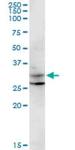 Invitrogen CENPP Monoclonal Antibody (3G8) 100 &mu;g; Unconjugated:Antibodies,