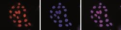Invitrogen H3K27ac Monoclonal Antibody, ChIP-Verified 10 &mu;g; Unconjugated:Antibodies,