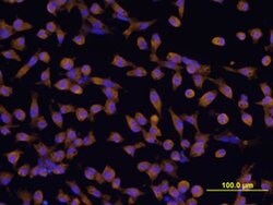 IL-22 Receptor alpha Rat anti-Mouse, Clone: 496514, Invitrogen 100 &mu;g;