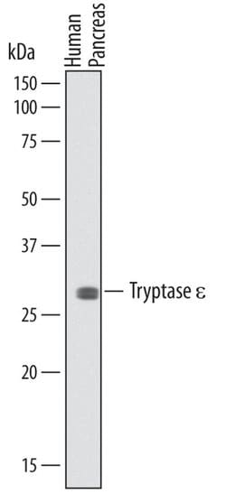 Invitrogen BSSP4 Monoclonal Antibody (725445) 100 &mu;g; Unconjugated:Antibodies,