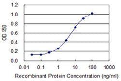 Invitrogen CYLC1 Monoclonal Antibody (6F12) 100 &mu;g; Unconjugated:Antibodies,