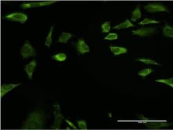 Invitrogen RPLP1 Monoclonal Antibody (1G10) 100 &mu;g; Unconjugated:Antibodies,