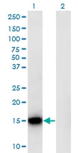 Invitrogen RPLP1 Monoclonal Antibody (1G10) 100 &mu;g; Unconjugated:Antibodies,