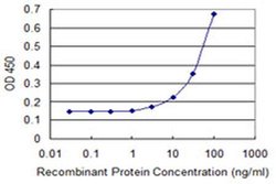 Invitrogen ZNF8 Monoclonal Antibody (2C6) 100 &mu;g; Unconjugated:Antibodies,