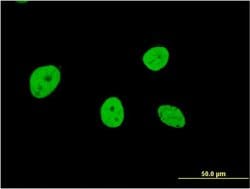 Invitrogen NOL4 Monoclonal Antibody (2A10) 100 &mu;g; Unconjugated:Antibodies,