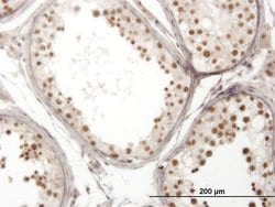 Invitrogen NOL4 Monoclonal Antibody (2A10) 100 &mu;g; Unconjugated:Antibodies,