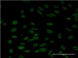 Invitrogen LSM6 Monoclonal Antibody (4B5-1B10) 100 &mu;g; Unconjugated:Antibodies,