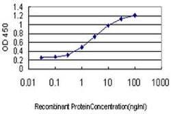 Invitrogen ZHX1 Monoclonal Antibody (5E5) 100 &mu;g; Unconjugated:Antibodies,