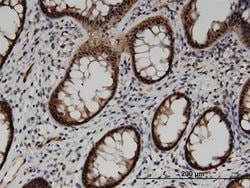 Invitrogen ACOT7 Monoclonal Antibody (1E7) 100 &mu;g; Unconjugated:Antibodies,