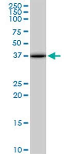 Invitrogen ACOT7 Monoclonal Antibody (1E7) 100 &mu;g; Unconjugated:Antibodies,