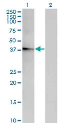 Invitrogen ACOT7 Monoclonal Antibody (1E7) 100 &mu;g; Unconjugated:Antibodies,