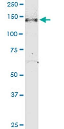 Invitrogen NPHP3 Monoclonal Antibody (3B1) 100 &mu;g; Unconjugated:Antibodies,