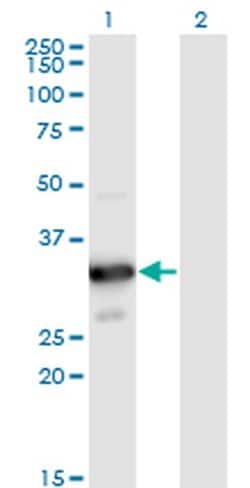 Invitrogen MYOZ2 Monoclonal Antibody (1D4) 100 &mu;g | Buy Online | Invitrogen&trade; | Fisher Scientific