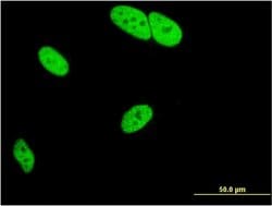 Invitrogen MED25 Monoclonal Antibody (7F1) 100 &mu;g; Unconjugated:Antibodies,