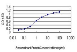 Invitrogen RNF220 Monoclonal Antibody (5E5) 100 &mu;g; Unconjugated:Antibodies,
