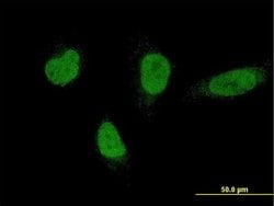 Invitrogen RNF220 Monoclonal Antibody (5E5) 100 &mu;g; Unconjugated:Antibodies,