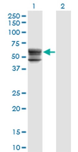 Invitrogen CHST12 Monoclonal Antibody (3D6) 100 &mu;g; Unconjugated:Antibodies,