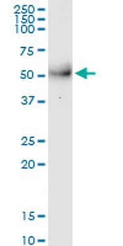 Invitrogen MPPE1 Monoclonal Antibody (3E4) 100 &mu;g; Unconjugated:Antibodies,