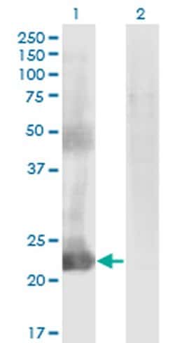 Invitrogen CCDC115 Monoclonal Antibody (4E9) 100 &mu;g; Unconjugated:Antibodies,
