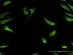 Invitrogen RBP7 Monoclonal Antibody (4F4) 100 &mu;g; Unconjugated:Antibodies,