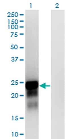 Invitrogen SPANXN3 Monoclonal Antibody (1F11) 100 &mu;g; Unconjugated:Antibodies,