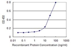 Invitrogen CENPV Monoclonal Antibody (1D9) 100 &mu;g; Unconjugated:Antibodies,