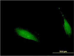 Invitrogen CENPV Monoclonal Antibody (1D9) 100 &mu;g; Unconjugated:Antibodies,