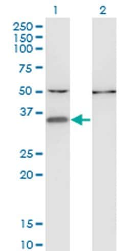 Invitrogen CENPV Monoclonal Antibody (1D9) 100 &mu;g; Unconjugated:Antibodies,