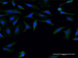 Invitrogen FMN1 Monoclonal Antibody (4F4) 100 &mu;g; Unconjugated:Antibodies,