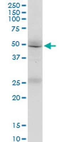 Invitrogen FMN1 Monoclonal Antibody (4F4) 100 &mu;g; Unconjugated:Antibodies,