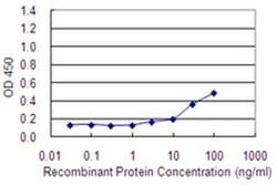Invitrogen MAGEA2 Monoclonal Antibody (1B1) 100 &mu;g; Unconjugated:Antibodies,