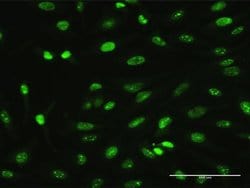 Invitrogen MAGEA2 Monoclonal Antibody (1B1) 100 &mu;g; Unconjugated:Antibodies,