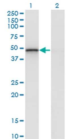 Invitrogen RCAN2 Monoclonal Antibody (1A9) 100 &mu;g; Unconjugated:Antibodies,