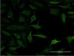 Invitrogen C14orf129 Monoclonal Antibody (2F2) 100 &mu;g; Unconjugated:Antibodies,