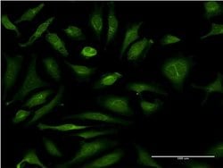 Invitrogen CSAD Monoclonal Antibody (2C11) 50 &mu;g; Unconjugated:Antibodies,