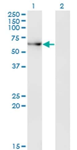 Invitrogen ACD Monoclonal Antibody (1C11-1A7) 100 &mu;g; Unconjugated:Antibodies,