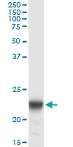 Invitrogen PMVK Monoclonal Antibody (2B8) 100 &mu;g | Buy Online | Invitrogen&trade; | Fisher Scientific