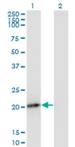Invitrogen PMVK Monoclonal Antibody (2B8) 100 &mu;g | Buy Online | Invitrogen&trade; | Fisher Scientific