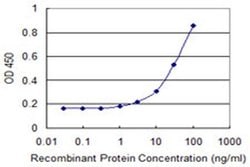 Invitrogen CDY2A Monoclonal Antibody (2E2) 100 &mu;g; Unconjugated:Antibodies,