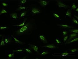 Invitrogen ZBTB25 Monoclonal Antibody (2E8) 100 &mu;g; Unconjugated:Antibodies,
