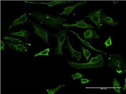 Invitrogen TSSK3 Monoclonal Antibody (3F9) 100 &mu;g; Unconjugated:Antibodies,