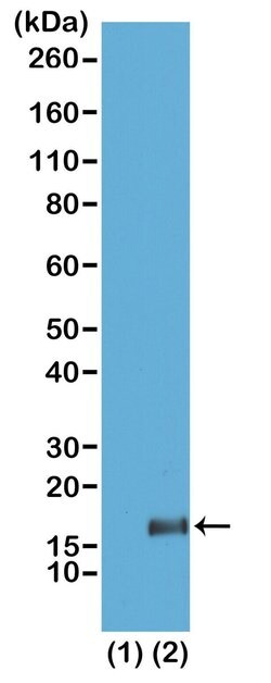H3K36me3 Rabbit anti-Human, Mouse, Clone: RM155, Invitrogen 20 &mu;g; Unconjugated:Antibodies,