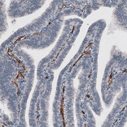 Invitrogen ELTD1 Monoclonal Antibody (CL4164) 100 &mu;L; Unconjugated:Antibodies,