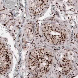 Invitrogen METTL14 Monoclonal Antibody (CL4252) 100 &mu;L; Unconjugated:Antibodies,